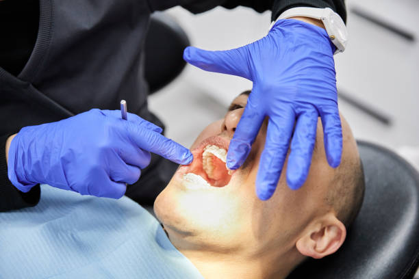 Best Broken or Cracked Tooth Emergency Dentist in Pleasure Point, CA